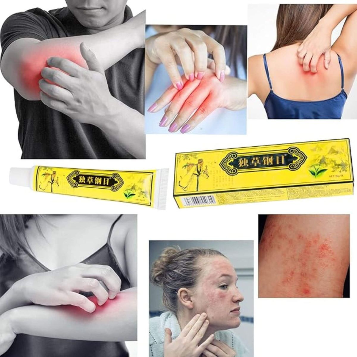 Super Crema Naturala Anti-Dermatita si Eczeme 5