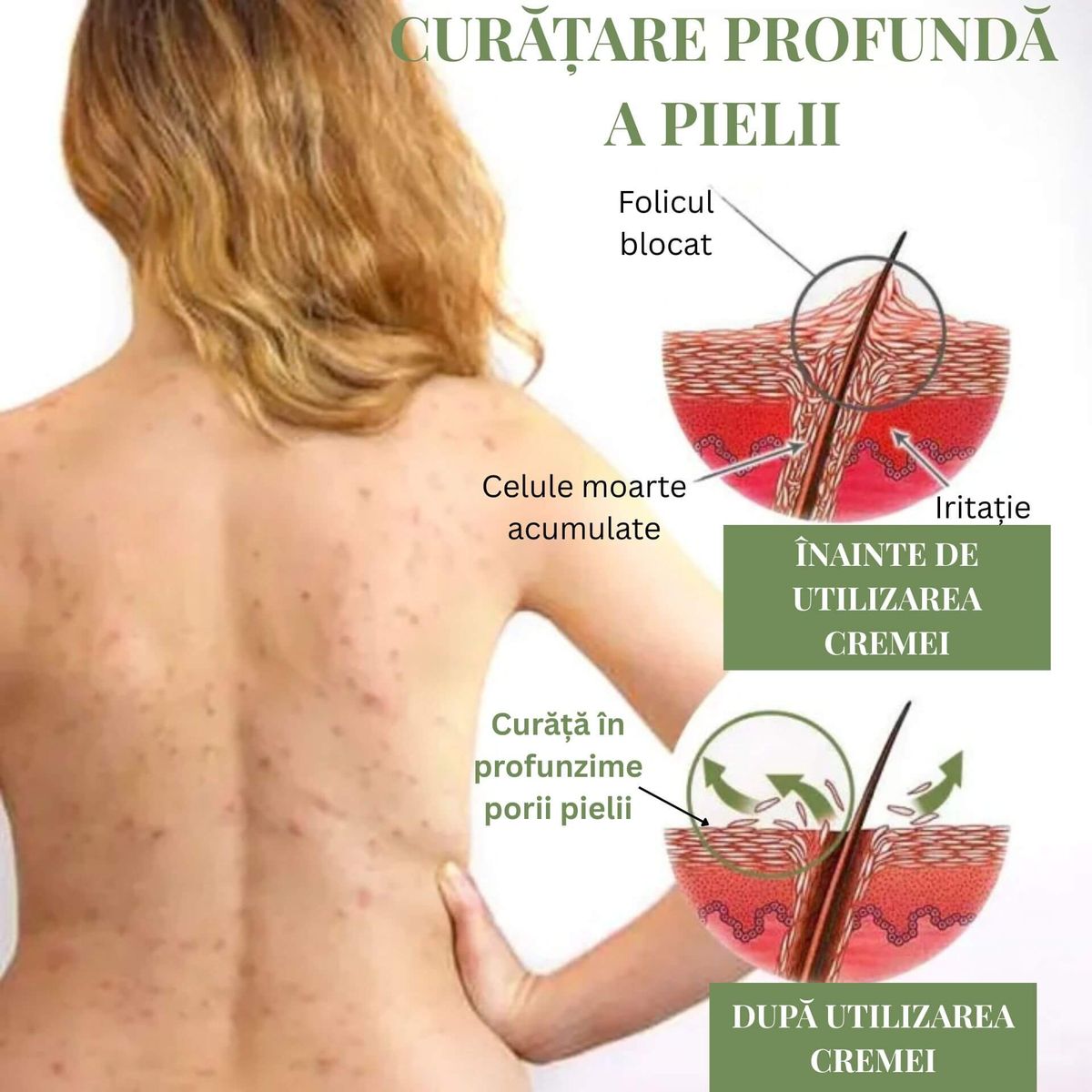 REGENERARE ȘI REVITALIZARE A PIELII