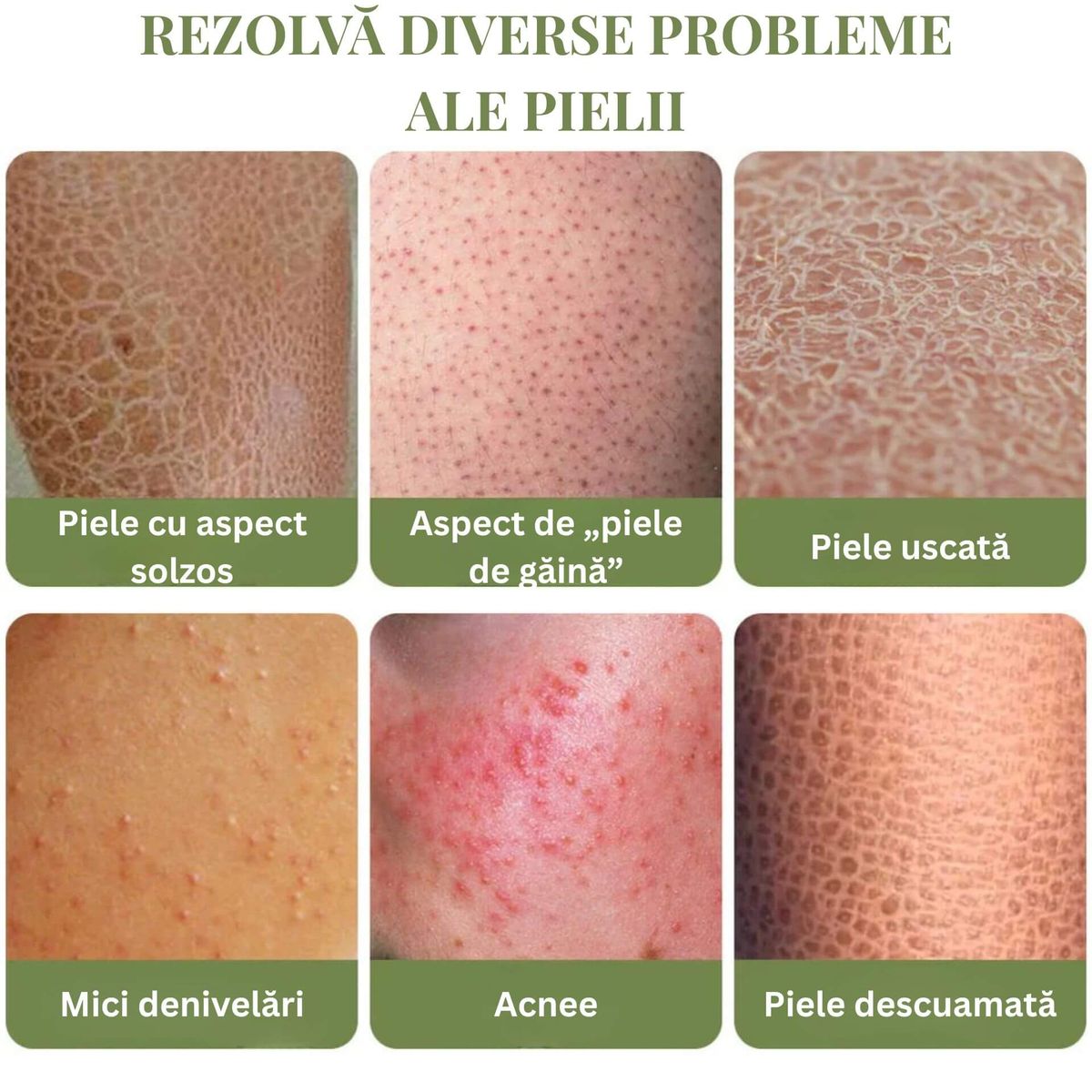 ÎMBUNĂTĂȚIREA ASPECTULUI GENERAL AL PIELII