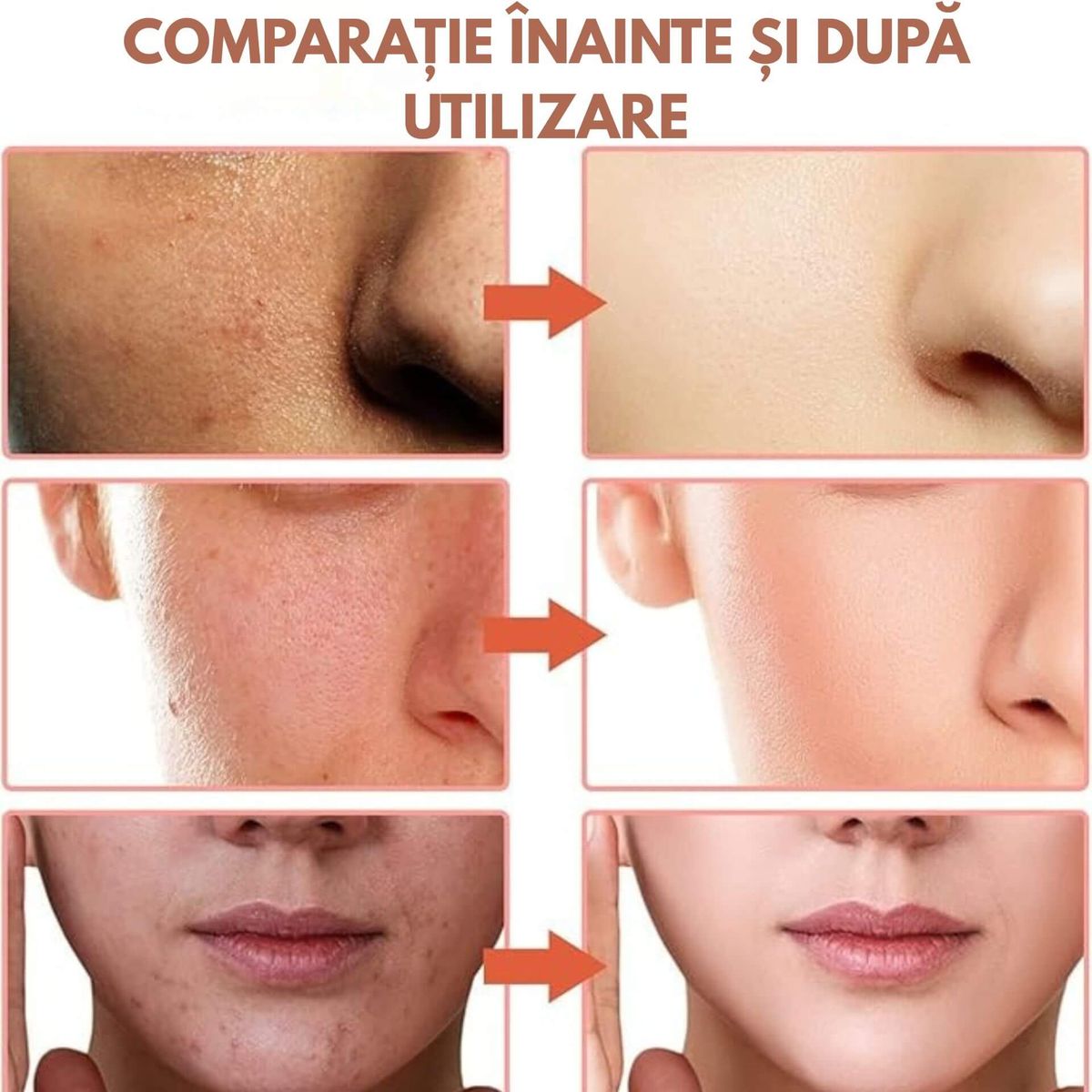 REDUCE LINIILE FINE ȘI RIDURILE