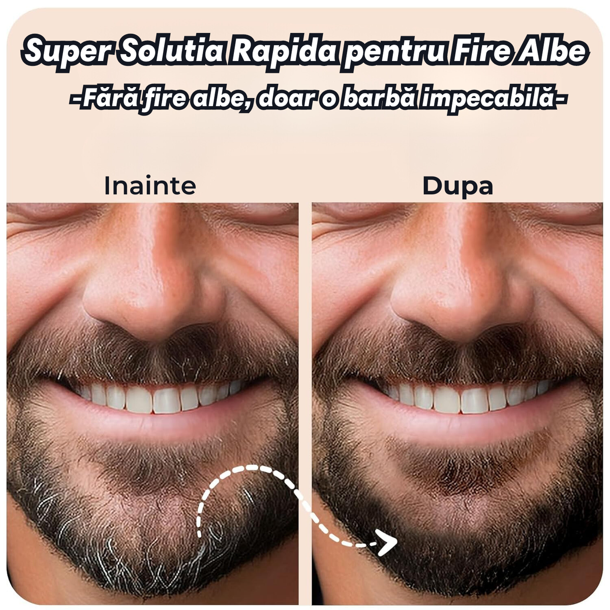 Super Solutia Rapida pentru Fire Albe 4