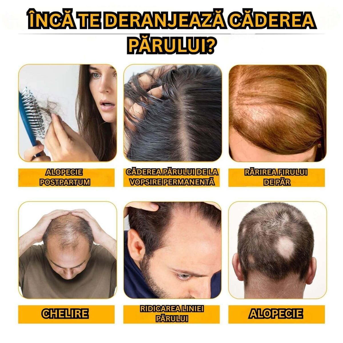 Tratament Natural cu Biotina Impotriva Caderii Parului 3
