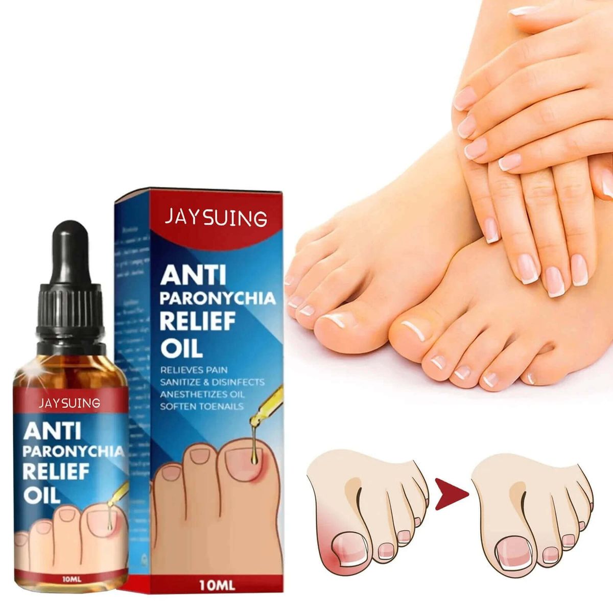 Ulei Antibacterian pentru Unghii 2