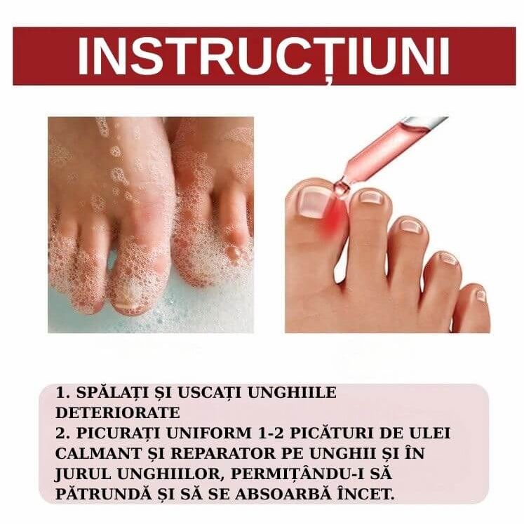 Ulei Antibacterian pentru Unghii 5