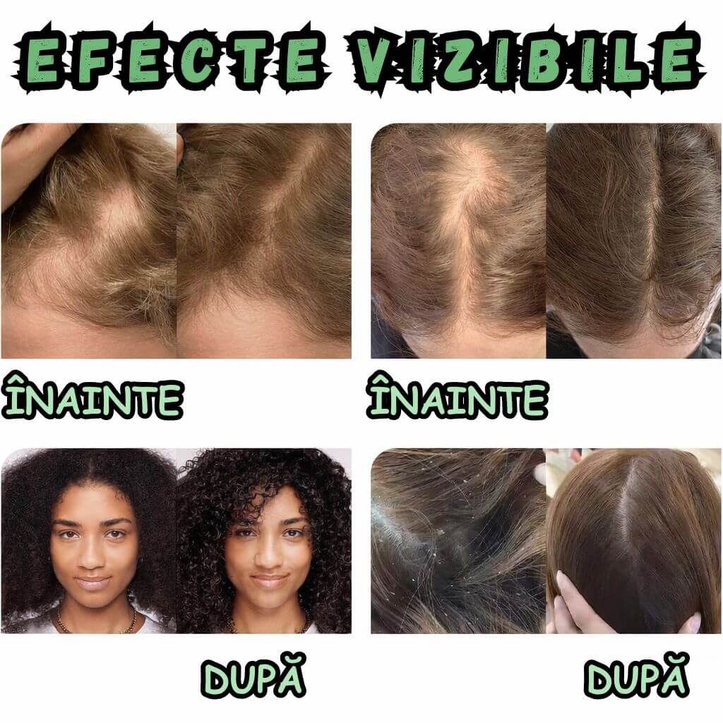SUSȚINE REFACEREA PĂRULUI AFECTAT DE SCHIMBĂRI HORMONALE