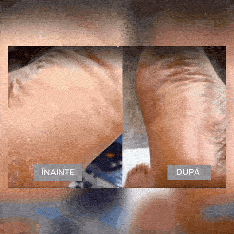 Ingredientul nr. 1 recomandat de dermatologi
