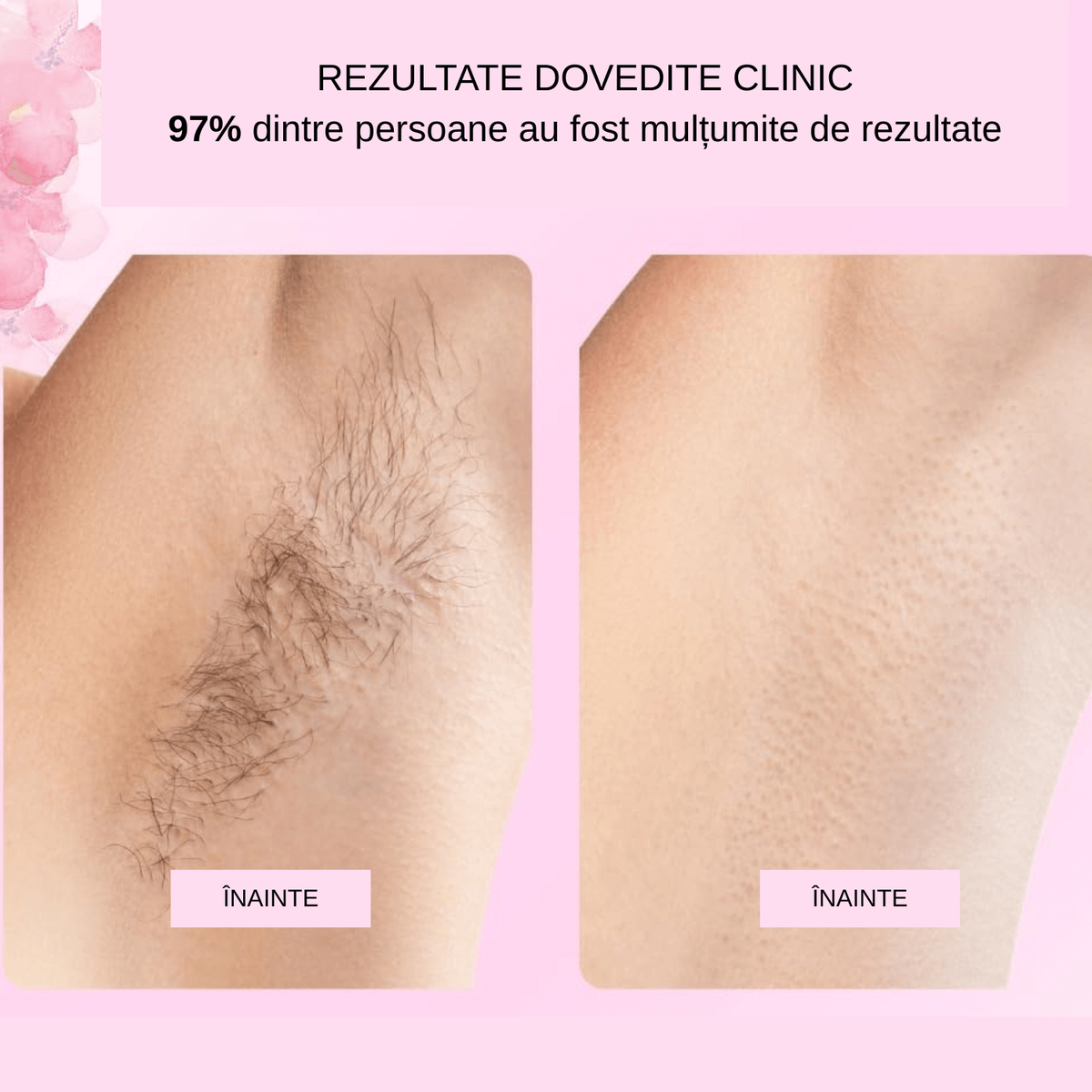 REZULTATE VIZIBILE ÎNAINTE / DUPĂ